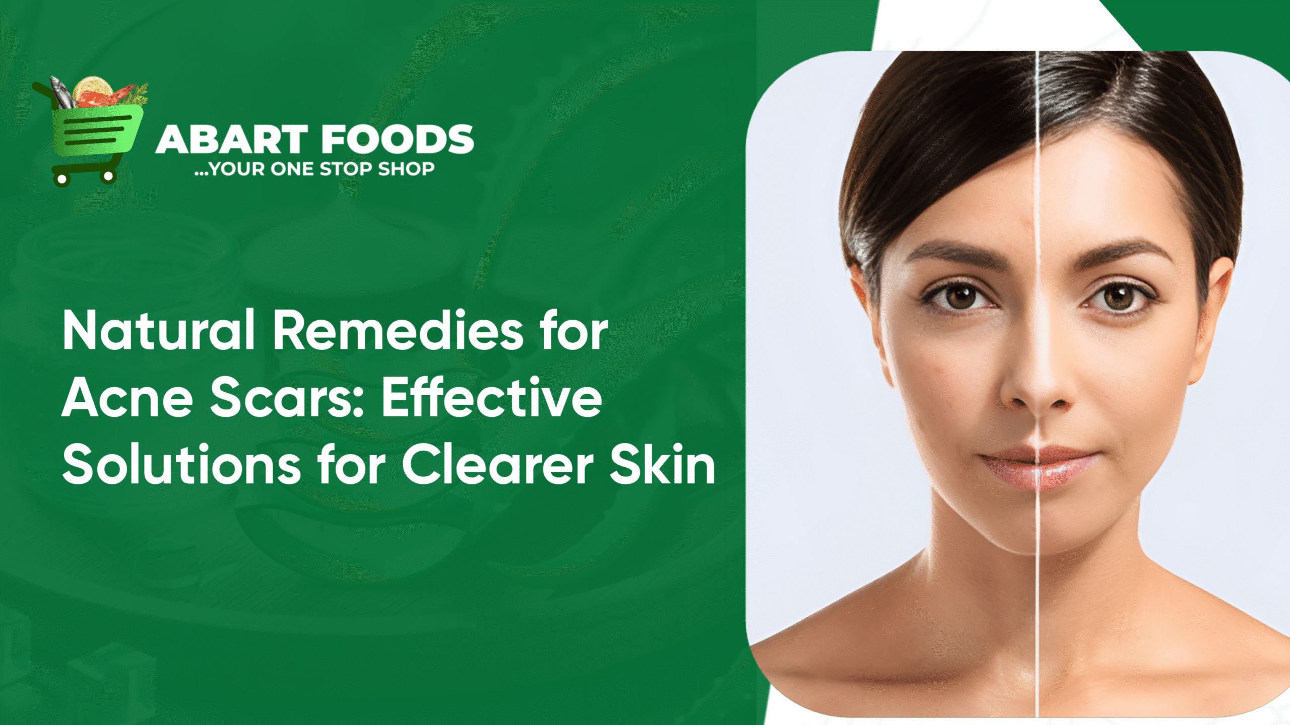 Image showcasing How to remove acne scars naturally within a week?