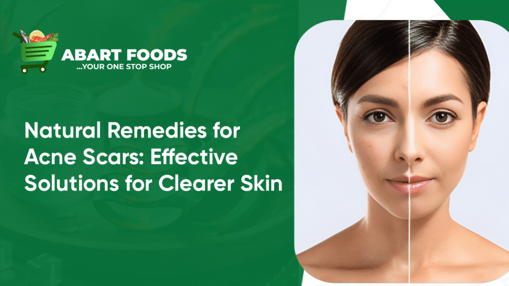 Natural remedies for acne scars